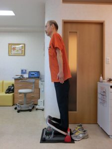 顎関節症